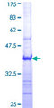TNFSF15 / TL1A / VEGI Protein - 12.5% SDS-PAGE Stained with Coomassie Blue.