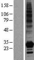 TNFSF4 / OX40L / CD252 Protein - Western validation with an anti-DDK antibody * L: Control HEK293 lysate R: Over-expression lysate