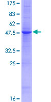 TNFSF4 / OX40L / CD252 Protein - 12.5% SDS-PAGE of human TNFSF4 stained with Coomassie Blue