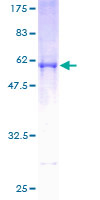 TNFSF5IP1 / CLAST3 Protein - 12.5% SDS-PAGE of human TNFSF5IP1 stained with Coomassie Blue