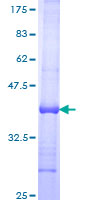 TNFSF9 / CD137L Protein - 12.5% SDS-PAGE Stained with Coomassie Blue.