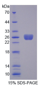 TNFSF9 / CD137L Protein - Recombinant Tumor Necrosis Factor Ligand Superfamily, Member 9 By SDS-PAGE