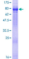TNIK Protein - 12.5% SDS-PAGE of human TNIK stained with Coomassie Blue