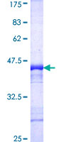TNIK Protein - 12.5% SDS-PAGE Stained with Coomassie Blue.