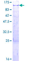 TNIP1 Protein - 12.5% SDS-PAGE of human TNIP1 stained with Coomassie Blue
