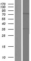 TNK1 Protein - Western validation with an anti-DDK antibody * L: Control HEK293 lysate R: Over-expression lysate