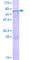 TNK2 / ACK1 Protein - 12.5% SDS-PAGE of human TNK2 stained with Coomassie Blue