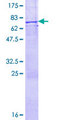 TNK2 / ACK1 Protein - 12.5% SDS-PAGE of human TNK2 stained with Coomassie Blue