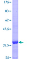 TNK2 / ACK1 Protein - 12.5% SDS-PAGE Stained with Coomassie Blue.