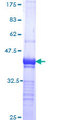 TNKS / Tankyrase Protein - 12.5% SDS-PAGE Stained with Coomassie Blue.