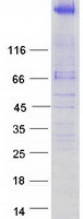 TNKS1BP1 / TAB182 Protein - Purified recombinant protein TNKS1BP1 was analyzed by SDS-PAGE gel and Coomassie Blue Staining