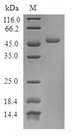 TNNC2 Protein - (Tris-Glycine gel) Discontinuous SDS-PAGE (reduced) with 5% enrichment gel and 15% separation gel.