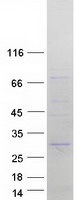 TNNI1 Protein - Purified recombinant protein TNNI1 was analyzed by SDS-PAGE gel and Coomassie Blue Staining