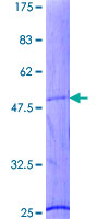 TNNI2 Protein - 12.5% SDS-PAGE of human TNNI2 stained with Coomassie Blue