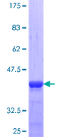 TNNI2 Protein - 12.5% SDS-PAGE Stained with Coomassie Blue.