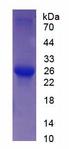 TNNI2 Protein - Recombinant Troponin I Type 2, Fast Skeletal (TNNI2) by SDS-PAGE