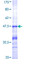TNNI3 / Cardiac Troponin I Protein - 12.5% SDS-PAGE Stained with Coomassie Blue.