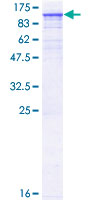 TNNI3K / CARK Protein - 12.5% SDS-PAGE of human TNNI3K stained with Coomassie Blue