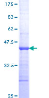 TNNI3K / CARK Protein - 12.5% SDS-PAGE Stained with Coomassie Blue.