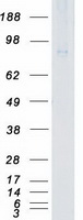 TNNI3K / CARK Protein - Purified recombinant protein TNNI3K was analyzed by SDS-PAGE gel and Coomassie Blue Staining