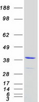 TNNT1 / TNT Protein - Purified recombinant protein TNNT1 was analyzed by SDS-PAGE gel and Coomassie Blue Staining