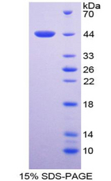 TNNT2 / CTNT Protein - Recombinant Troponin T Type 2, Cardiac By SDS-PAGE