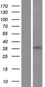 TNNT3 Protein - Western validation with an anti-DDK antibody * L: Control HEK293 lysate R: Over-expression lysate