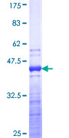 TNNT3 Protein - 12.5% SDS-PAGE Stained with Coomassie Blue.