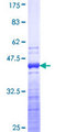 TNNT3 Protein - 12.5% SDS-PAGE Stained with Coomassie Blue.