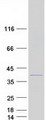 TNNT3 Protein - Purified recombinant protein TNNT3 was analyzed by SDS-PAGE gel and Coomassie Blue Staining