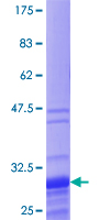 TNP1 / TP1 Protein - 12.5% SDS-PAGE of human TNP1 stained with Coomassie Blue