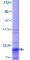 TNP1 / TP1 Protein - 12.5% SDS-PAGE of human TNP1 stained with Coomassie Blue