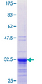 TNP1 / TP1 Protein - 12.5% SDS-PAGE Stained with Coomassie Blue.