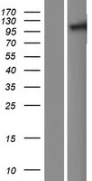 TNPO2 / Importin Protein - Western validation with an anti-DDK antibody * L: Control HEK293 lysate R: Over-expression lysate