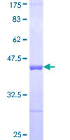 TNR / Tenascin R Protein - 12.5% SDS-PAGE Stained with Coomassie Blue.