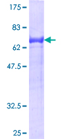 TNS1 / Tensin-1 Protein - 12.5% SDS-PAGE of human TNS1 stained with Coomassie Blue