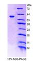 TNS1 / Tensin-1 Protein - Recombinant Tensin 1 By SDS-PAGE
