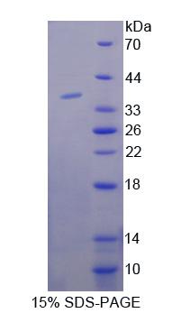 TNS3 / Tensin 3 Protein - Recombinant  Tensin 3 By SDS-PAGE