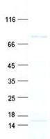 TNXB / Tenascin XB Protein