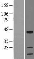TOB1 / TOB Protein - Western validation with an anti-DDK antibody * L: Control HEK293 lysate R: Over-expression lysate