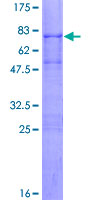 TOB1 / TOB Protein - 12.5% SDS-PAGE of human TOB1 stained with Coomassie Blue