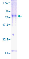 TOB2 Protein - 12.5% SDS-PAGE of human TOB2 stained with Coomassie Blue