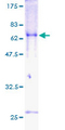 TOB2 Protein - 12.5% SDS-PAGE of human TOB2 stained with Coomassie Blue