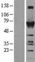 TOE1 Protein - Western validation with an anti-DDK antibody * L: Control HEK293 lysate R: Over-expression lysate