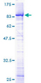 TOE1 Protein - 12.5% SDS-PAGE of human TOE1 stained with Coomassie Blue
