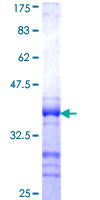 TOM1 Protein - 12.5% SDS-PAGE Stained with Coomassie Blue.