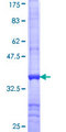 TOM1L1 Protein - 12.5% SDS-PAGE Stained with Coomassie Blue.