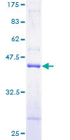 TOMM20 Protein - 12.5% SDS-PAGE of human TOMM20 stained with Coomassie Blue