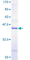 TOMM20 Protein - 12.5% SDS-PAGE of human TOMM20 stained with Coomassie Blue