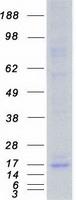 TOMM20 Protein - Purified recombinant protein TOMM20 was analyzed by SDS-PAGE gel and Coomassie Blue Staining